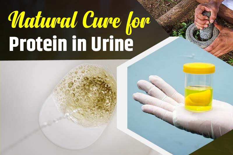 Natural Cure for Protein in Urine
